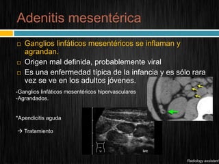 imagenolog-a-del-abdomen-agudo-pptx