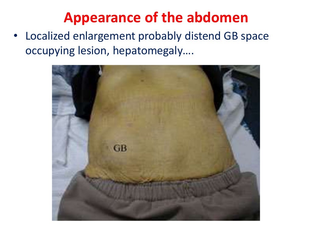 Abdoiminal examination