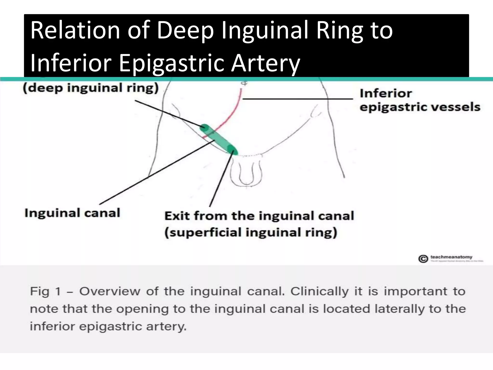 Abdoman ppt 2 (Inguinal region).pptx