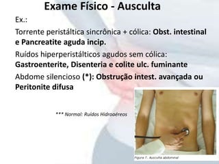 Ex.:
Torrente peristáltica sincrônica + cólica: Obst. intestinal
e Pancreatite aguda incip.
Ruídos hiperperistálticos agudos sem cólica:
Gastroenterite, Disenteria e colite ulc. fuminante
Abdome silencioso (*): Obstrução intest. avançada ou
Peritonite difusa
Exame Físico - Ausculta
*** Normal: Ruídos Hidroaéreos
 