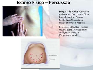 Exame Físico – Percussão
Pesquisa de Ascite: Colocar o
paciente em Dec. Lateral Dir. e
Esq. e Percutir os Flancos:
Região livre: Timpanismo
Região encostada: Macicez
Detecção de Líquidos (macicez
móvel), Gases (macicez local)
ou Alças aprisionadas
(Timpanismo local)
 