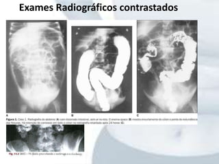 Exames Radiográficos contrastados
 