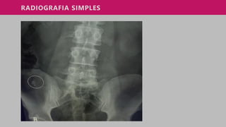 RADIOGRAFIA SIMPLES
 