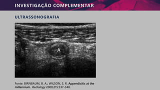 INVESTIGAÇÃO COMPLEMENTAR
ULTRASSONOGRAFIA
Fonte: BIRNBAUM, B. A.; WILSON, S. R. Appendicitis at the
millennium. Radiology 2000;215:337-348.
 