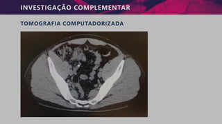 INVESTIGAÇÃO COMPLEMENTAR
TOMOGRAFIA COMPUTADORIZADA
 