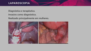 LAPAROSCOPIA
Diagnóstica e terapêutica.
Invasivo como diagnóstico.
Realizado principalmente em mulheres.
 