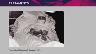 TRATAMENTO
Fonte: Leonid Ivanovich Rogozov, 1961.
 