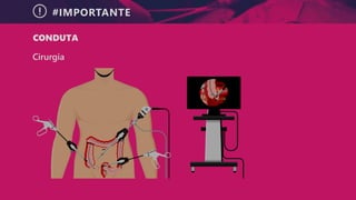 #IMPORTANTE
CONDUTA
Cirurgia
 