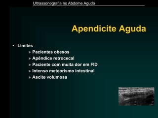 Ultrassonografia no Abdome Agudo
Apendicite Aguda
• Limites
» Pacientes obesos
» Apêndice retrocecal
» Paciente com muita dor em FID
» Intenso meteorismo intestinal
» Ascite volumosa
 