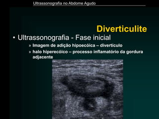 Ultrassonografia no Abdome Agudo
• Ultrassonografia - Fase inicial
» Imagem de adição hipoecóica – divertículo
» halo hiperecóico – processo inflamatório da gordura
adjacente
Diverticulite
 