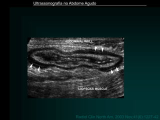 Ultrassonografia no Abdome Agudo
Radiol Clin North Am. 2003 Nov;41(6):1227-42
 