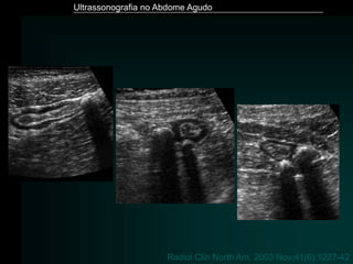 Ultrassonografia no Abdome Agudo
Radiol Clin North Am. 2003 Nov;41(6):1227-42
 