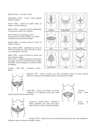 Babcock (1916) – ressecção vertical;
Schepelmann (1918) – incisão vertical alargada
abaixo do umbigo;
Thorek (1924) – excisão em semilua abaixo do
umbigo, sem descolamentos;
Küster (1926) – ressecção vertical quadrangular,
com pequenas incisões nos 4 ângulos;
Flesch-Thebesius e Wheisheimer (1931) –
ressecção transversa infra-umbilical com retalho
triangular para preservação do umbigo
Somalo (1940) – ressecção circular do tronco em
forma de cinturão.
Pick e Barsky (1949) – modificação da técnica de
Thorek com retirada de tecido em cunha, no centro
e nas extremidades da incisão.
Galtier (1955) – incisão em forma de estrela, com
preservação do umbigo
Venon (1957) – primeira descrição de transposição
do umbigo através de uma incisão baixa no retalho
abdominal, com descolamento da porção inferior
do abdômen;
Gonzalez - Ulloa 1960 – semelhante a Pick e
Barsky.
Spadafora 1962 – incisão curvilínea que desce lateralmente abaixo da prega inguinal,
realizava descolamento do abdômen superior e transposição do umbigo.
Callia (1967) – descreve sua técnica com incisão curvilínea,
semelhante a de Spadafora, porém mais baixa, dando muita
atenção à parede músculo-aponeurótica.
Castanares e Goethel (1967) – modificam a técnica de
Galtier, realizando uma estrela com ápices desiguais e
removendo mais tecido no sentido horizontal;
Pitanguy (1967) – propõe ressecção horizontal baixa direcionada para baixo lateralmente,
utilizando amplo descolamento da região superior.
 