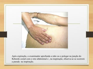 Sinal de Murphy
Após expiração, o examinador aprofunda a mão ou o polegar na junção do
Rebordo costal com o reto abdominal e , na inspiração, observa-se se ocorrerá
a parada na inspiração.
 