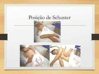 Posição de Schuster
 