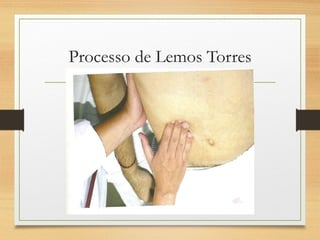 Processo de Lemos Torres
 