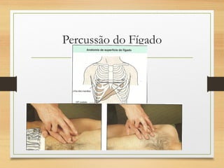 Percussão do Fígado
 