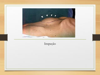 Inspeção
 
