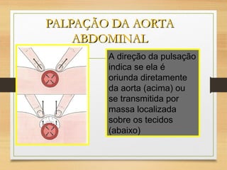 PALPAÇÃO DA AORTAPALPAÇÃO DA AORTA
ABDOMINALABDOMINAL
A direção da pulsação
indica se ela é
oriunda diretamente
da aorta (acima) ou
se transmitida por
massa localizada
sobre os tecidos
(abaixo)
 