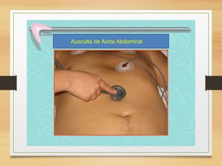 Ausculta da Aorta Abdominal
 