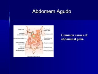 Common causes ofCommon causes of
abdominal pain.abdominal pain.
Abdomem AgudoAbdomem Agudo
 