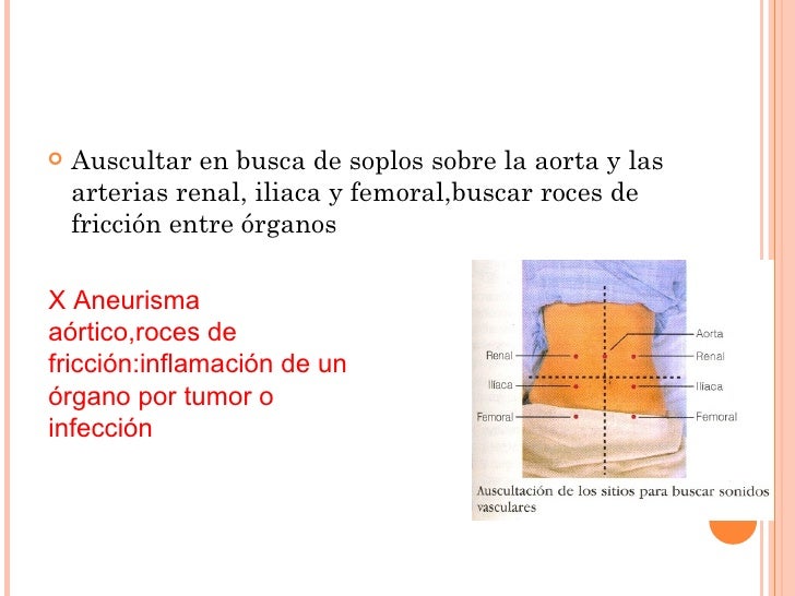 Abdomen