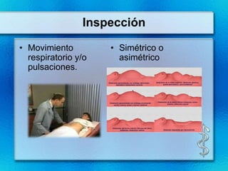 Inspección

• Movimiento         • Simétrico o
  respiratorio y/o     asimétrico
  pulsaciones.
 