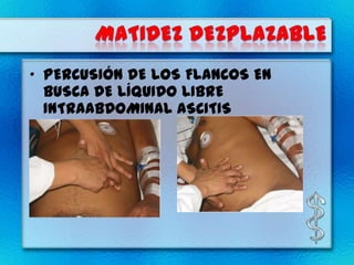 • PERCUSIÓN DE LOS FLANCOS EN
  BUSCA DE LÍQUIDO LIBRE
  INTRAABDOMINAL ASCITIS
 