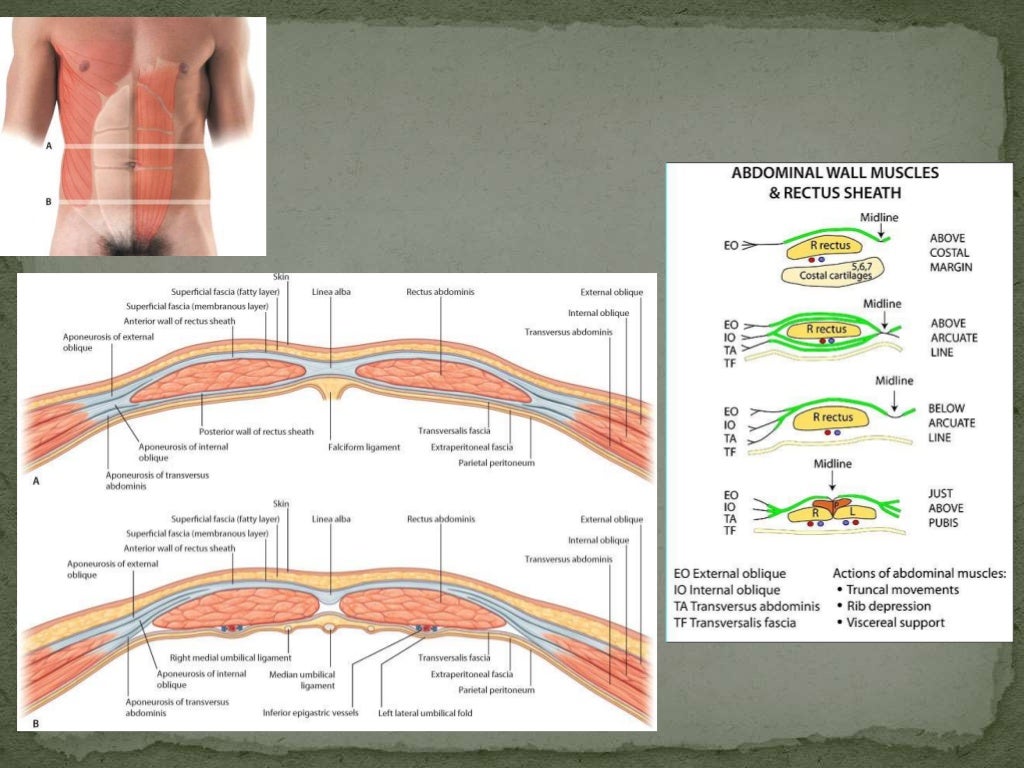 Abdomen layers & surgical incisions