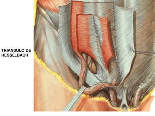 TRIANGULO DE
HESSELBACH
 