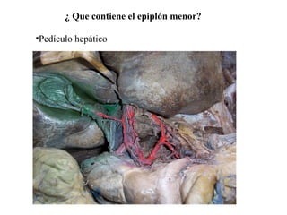 ¿ Que contiene el epiplón menor?
•Pedículo hepático
 