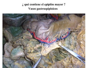 ¿ qué contiene el epiplón mayor ?
Vasos gastroepiploicos
 