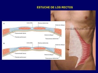 ESTUCHE DE LOS RECTOS
 