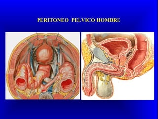 PERITONEO PELVICO HOMBRE
 