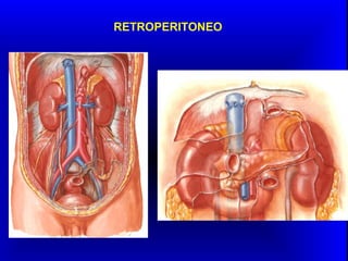 RETROPERITONEO
 