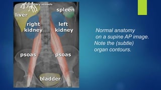 Normal Supin Abdomen imaging.pptx