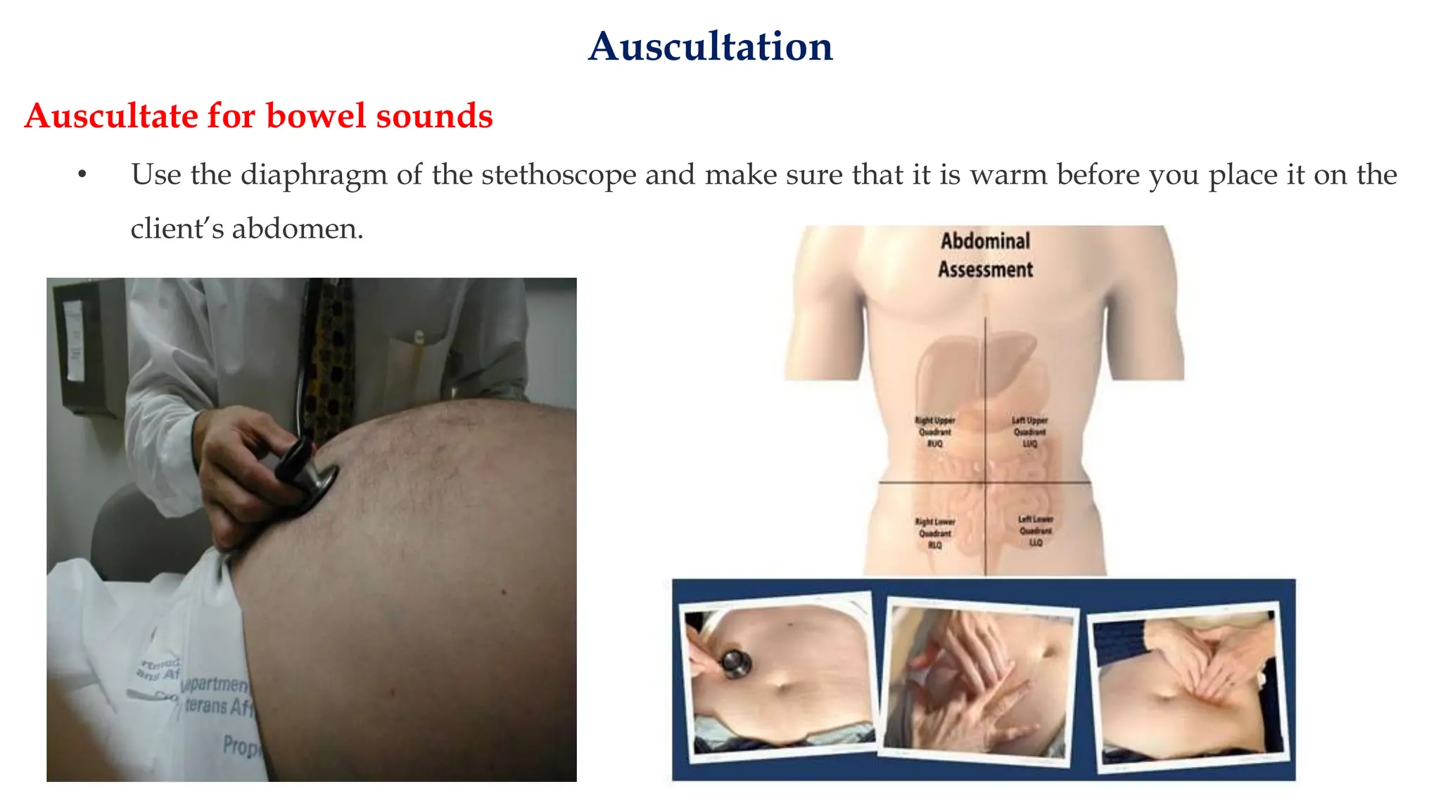 Clinical Examinations Of The Abdomen With Images PPTX