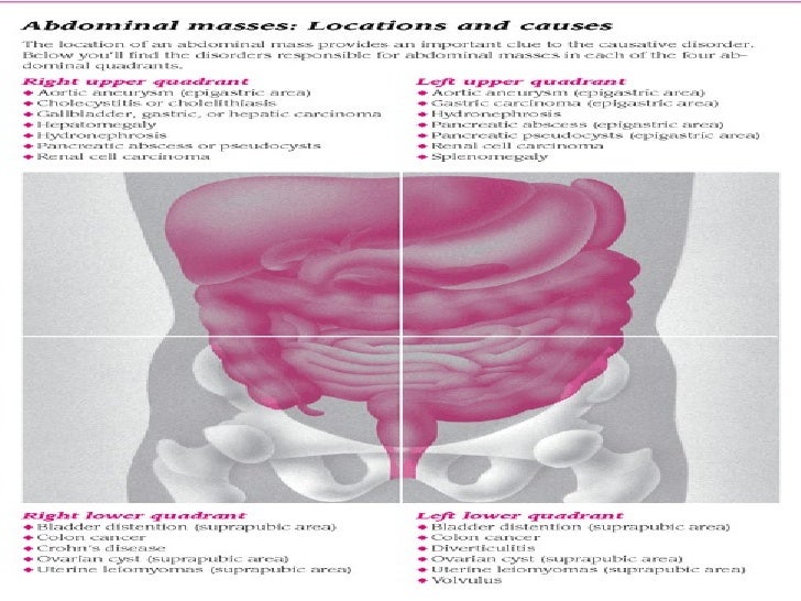 Hyperactive bowel sounds and abdominal pain cowDer
