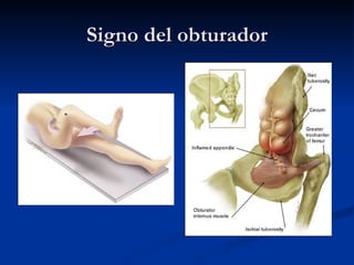 Signo del obturador 