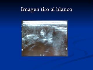 Imagen tiro al blanco 