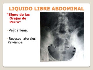 LIQUIDO LIBRE ABDOMINAL
“Signo de las
Orejas de
Perro”
◦ Vejiga llena.
◦ Recesos laterales
Pelvianos.
 
