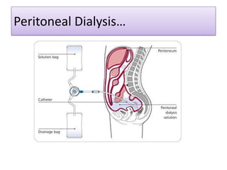 Peritoneal Dialysis…

 
