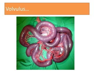 Volvulus…

 