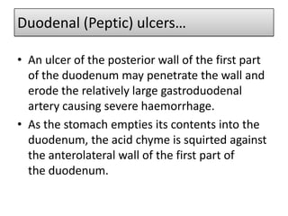 Duodenal (Peptic) ulcers…
• An ulcer of the posterior wall of the first part
of the duodenum may penetrate the wall and
erode the relatively large gastroduodenal
artery causing severe haemorrhage.
• As the stomach empties its contents into the
duodenum, the acid chyme is squirted against
the anterolateral wall of the first part of
the duodenum.

 