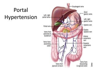Portal
Hypertension

 