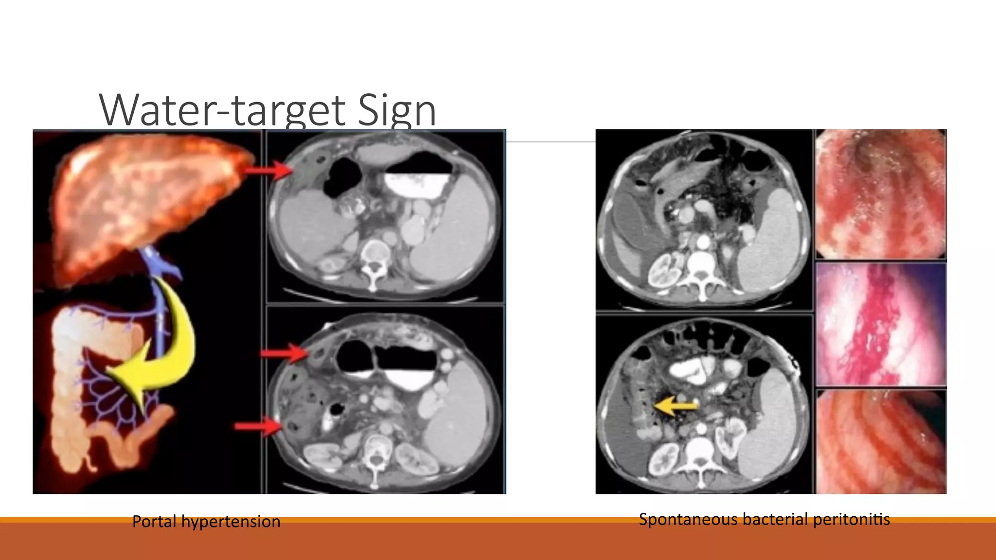 Abdominal radiology pattern recognition | PDF