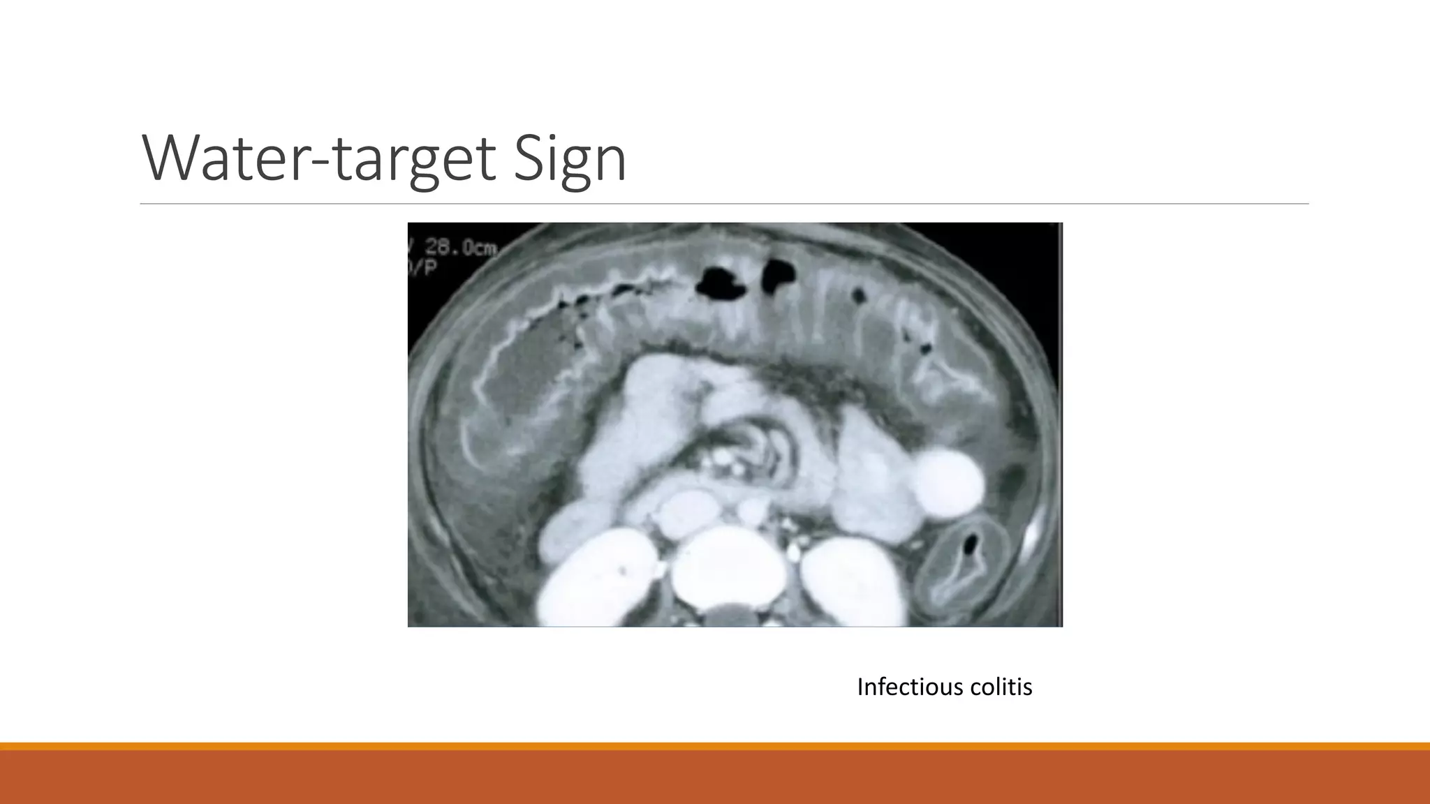 Abdominal radiology pattern recognition | PDF
