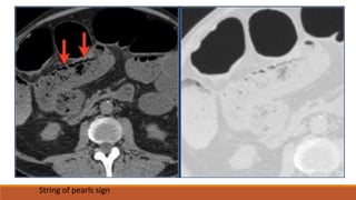 Abdominal radiology pattern recognition | PDF