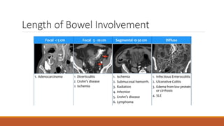 Abdominal radiology pattern recognition | PDF