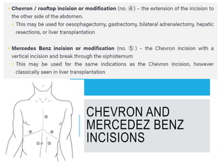 CHEVRON AND
MERCEDEZ BENZ
INCISIONS
 